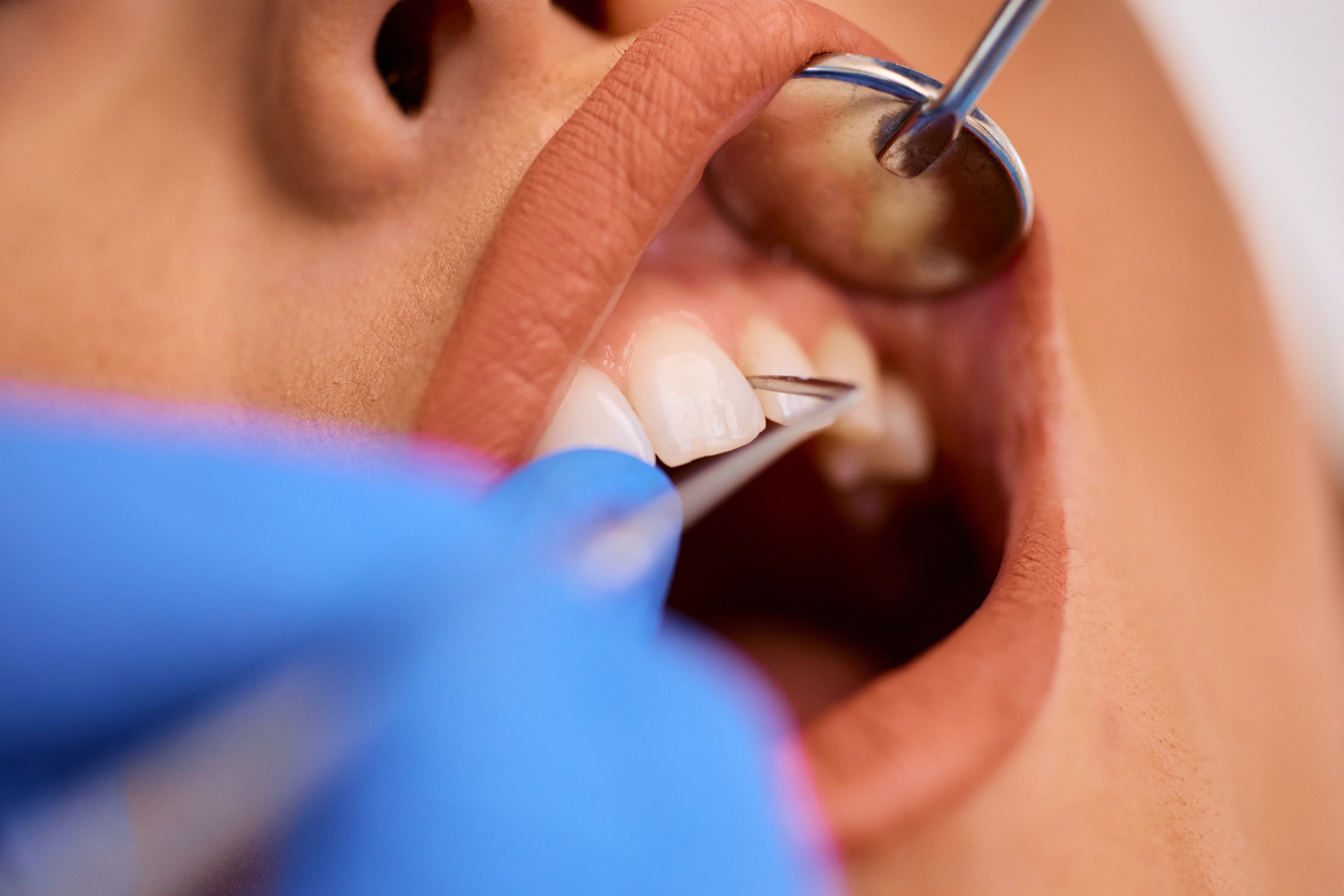 ¿Cada cuánto debo ir al dentista? Guía de controles